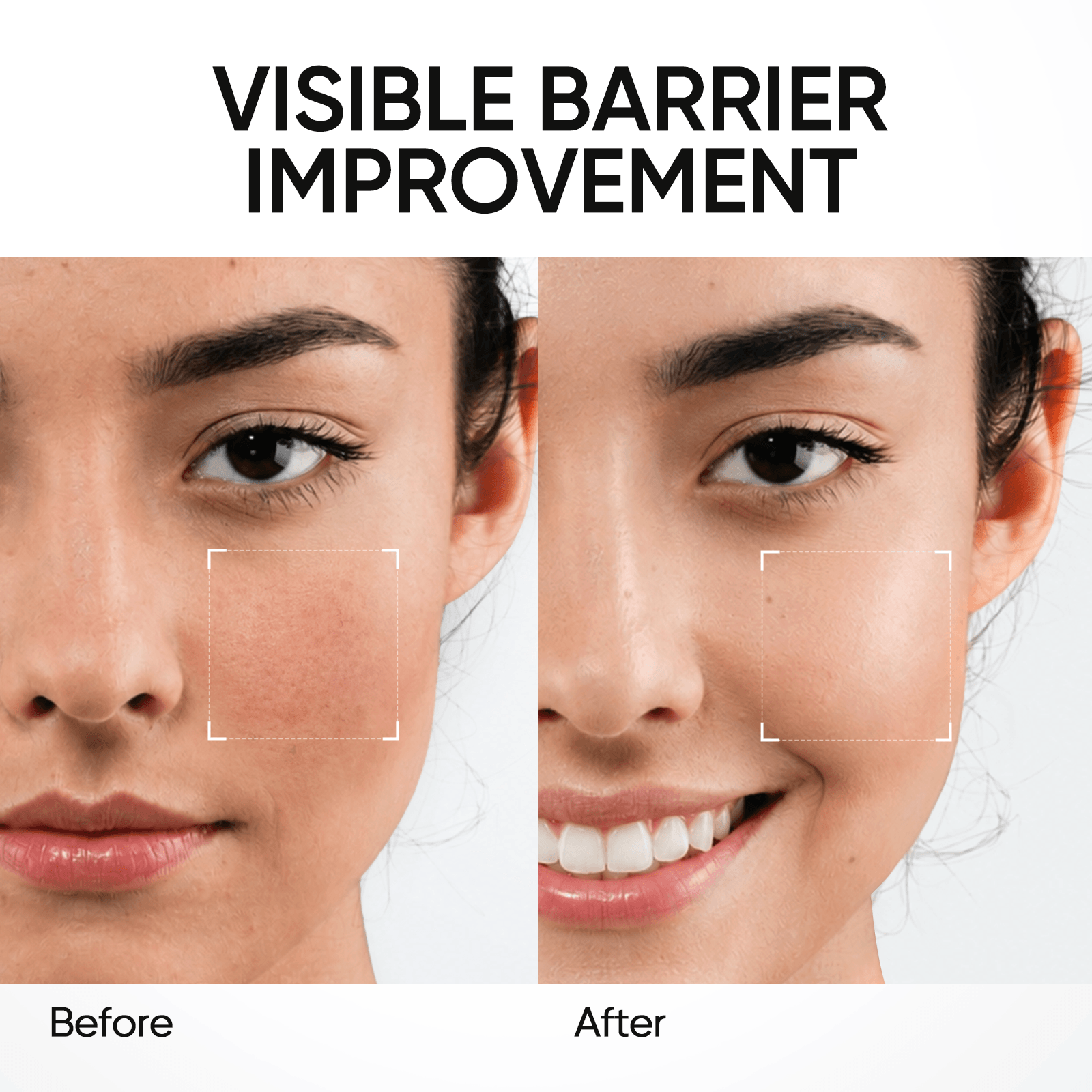 5X Ceramide Barrier Face Moisture Gel Light Texture