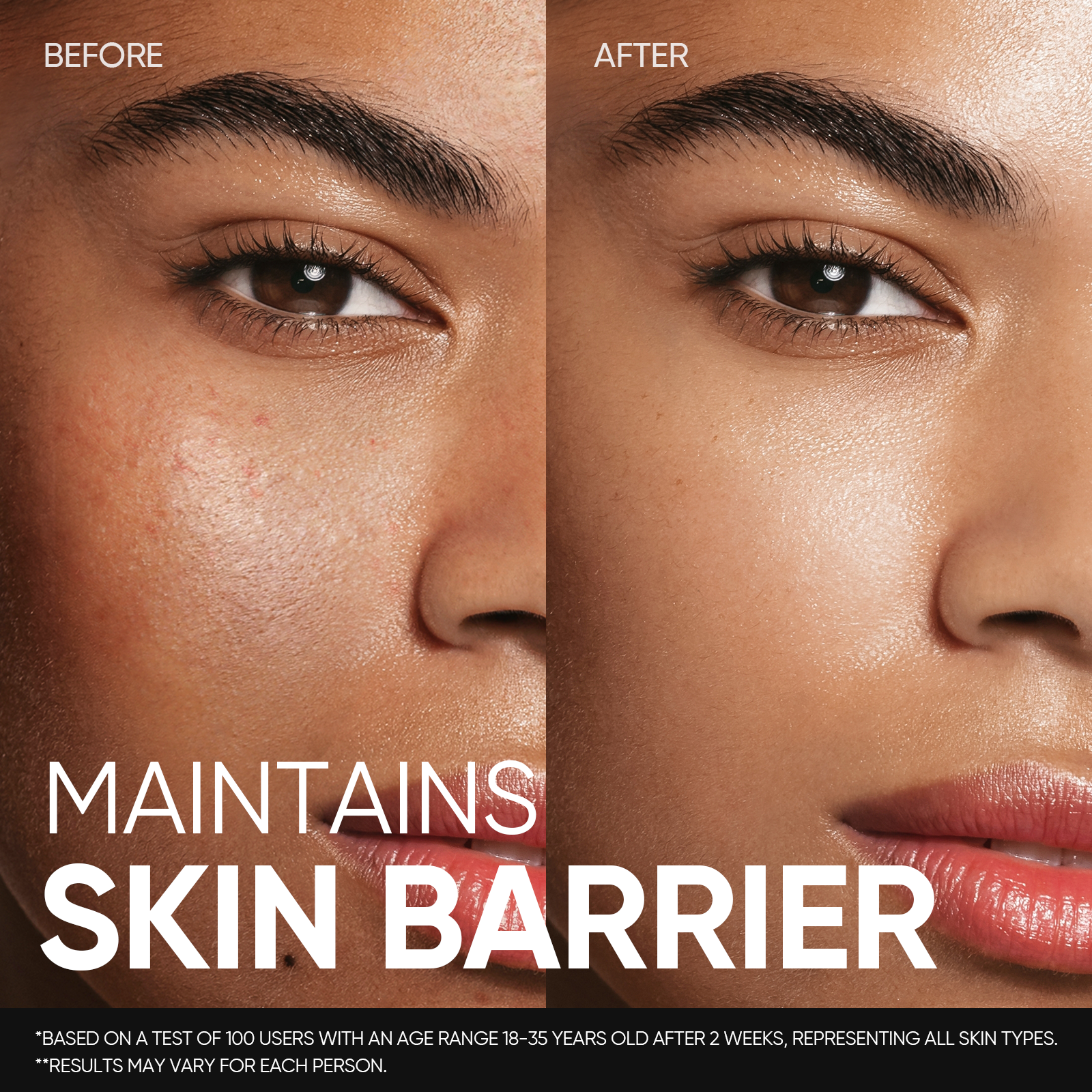 5X Ceramide Soothing Toner