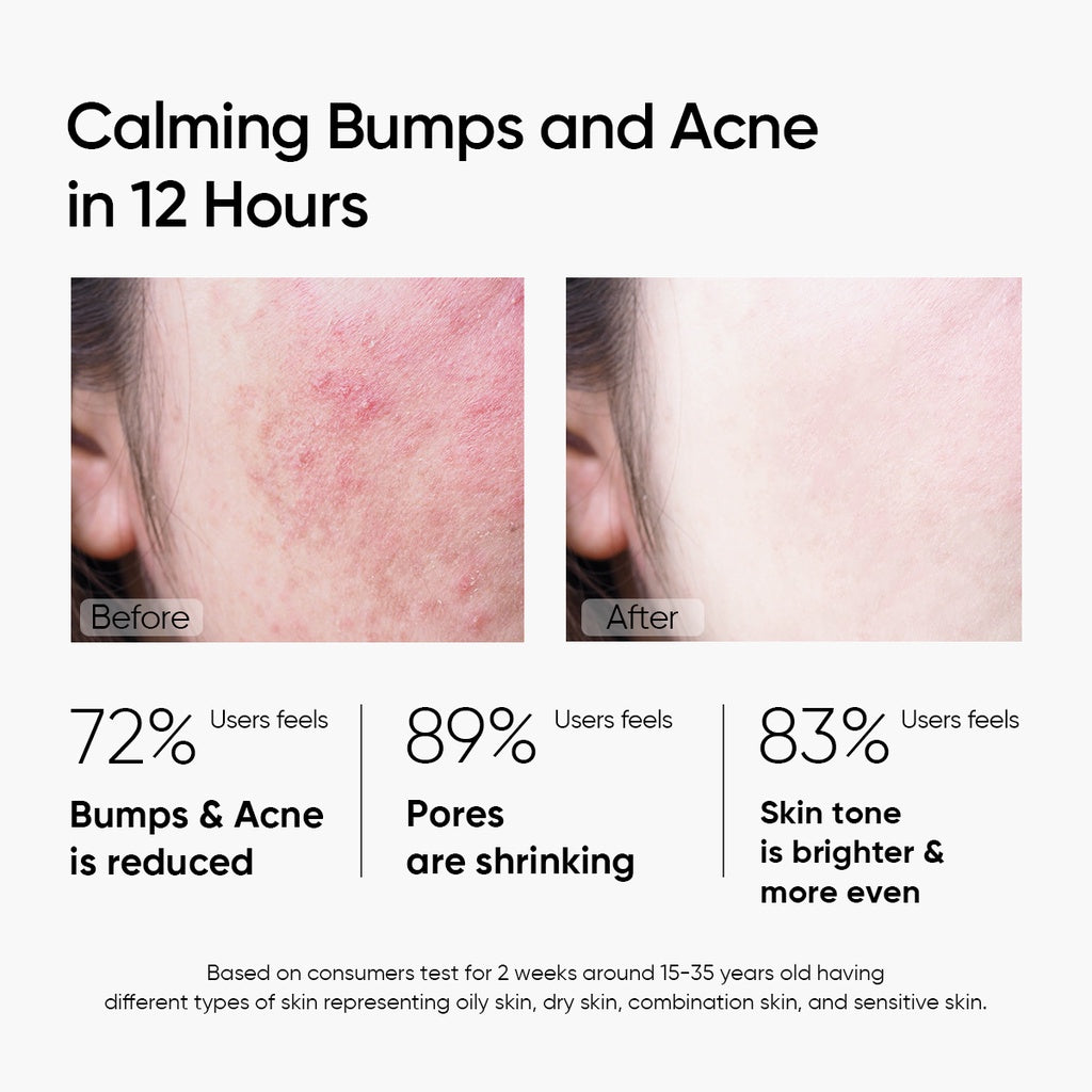 Mugwort Anti Pores & Acne Clay Mask